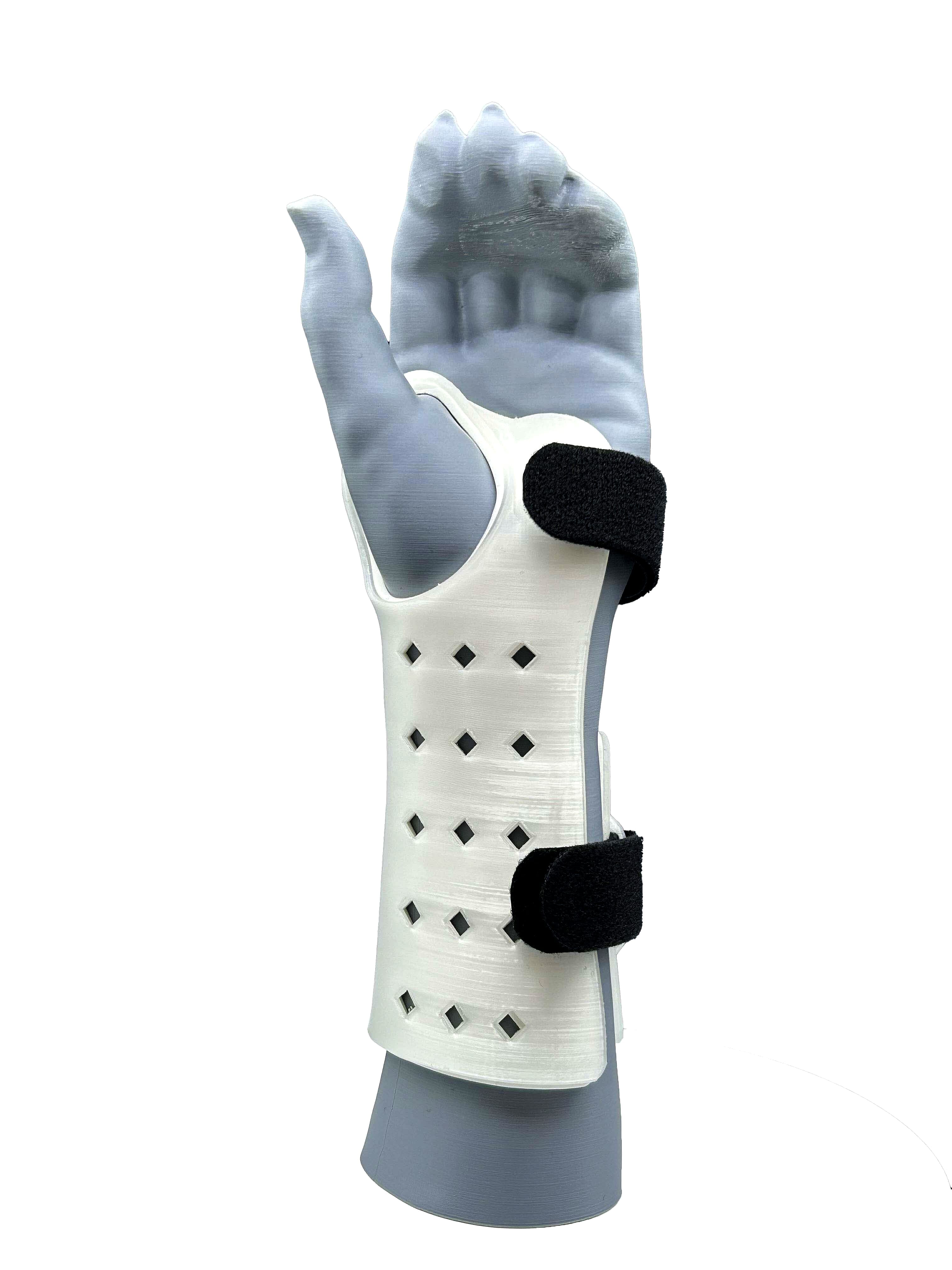 Gauntlet Splint